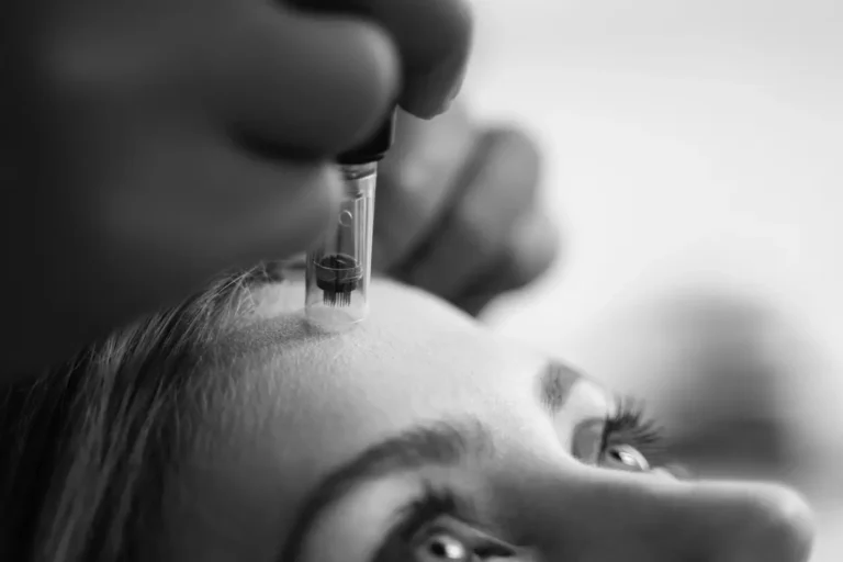Microneedling Treatments